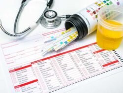 Puluhan Anggota Disdamkartan Bontang di Tes Urine, Hasilnya Negatif